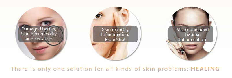 NOX BELLCOW-Find Skin Products Skin Moisturizer Anthyllis Vulneraria Healing Series