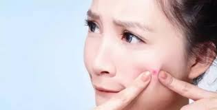 NOX BELLCOW-Cosmetics Manufacturer-whats To Blame Of The Acne On Your Face