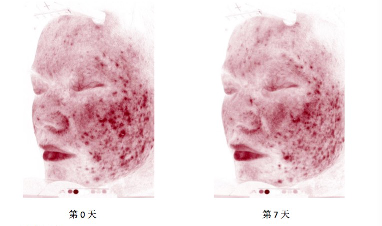 news-NOX BELLCOW-Why can FN Fibronectin repair skin, remove acne, as well as fade fine wrinkles-img-2