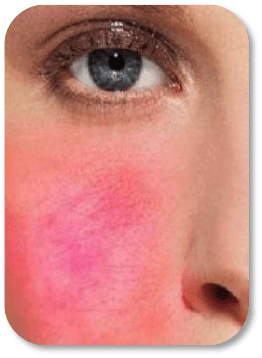 NOX BELLCOW-Facial Treatment Mask | Sos Stress Relief Revitalizing Mask-3